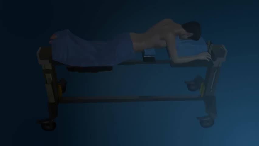 Spinal surgery animation: minimally invasive spine fusion technique and surgical procedure guide