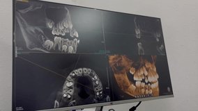 3D X-ray, image of strong children's teeth on the monitor of an orthodontist, Russia, Moscow, 05.29.2025
 - Powered by Shutterstock - Get 15% off with code: PIKWIZARD15