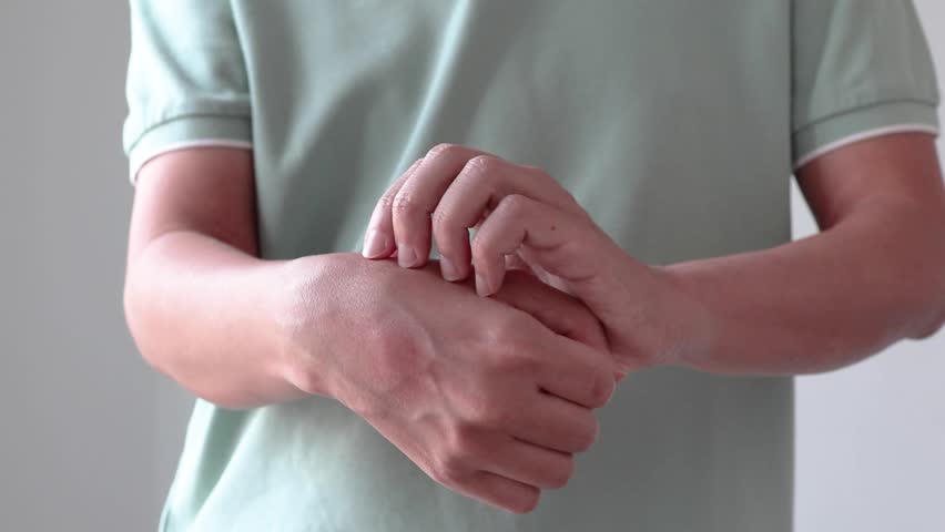 Young asian man itching and scratching on arm from allergic itchy dry skin eczema dermatitis insect bites