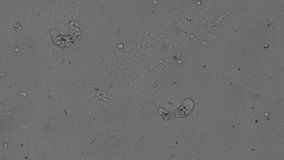 Fast motion microscopy showing amoeba movement in a single drop of water, revealing hidden biological activity. - Powered by Shutterstock - Get 15% off with code: PIKWIZARD15