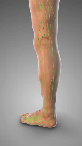 Accumulated Fluid Triggering Pitting Edema