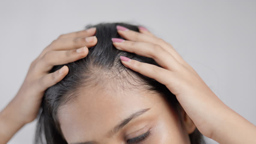 Hairloss, androgenic alopecia, receding hairline, a woman touching her thinning hair in white background.