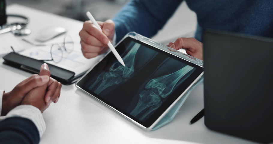 Hands, tablet and doctor with x ray, knees and consulting with results for patient at hospital. People, medical review and radiology scan for legs, bones and injury with consultation at clinic