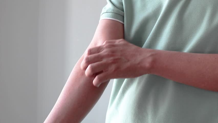 Young asian man itching and scratching on arm from allergic itchy dry skin eczema dermatitis insect bites