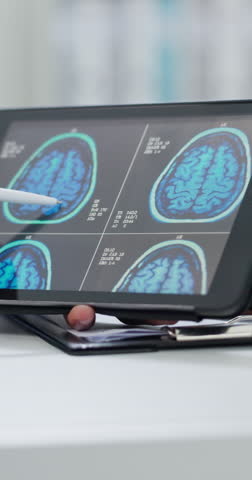 Doctor, hands and tablet screen with brain scan for MRI, examination or x ray results at hospital. Closeup, medical person or neurology with patient or technology display for consultation at clinic