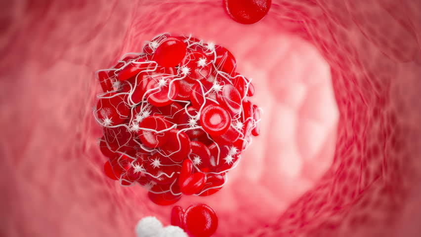 3D illustration of a blood clot, red blood with white blood cells isolate on white background.