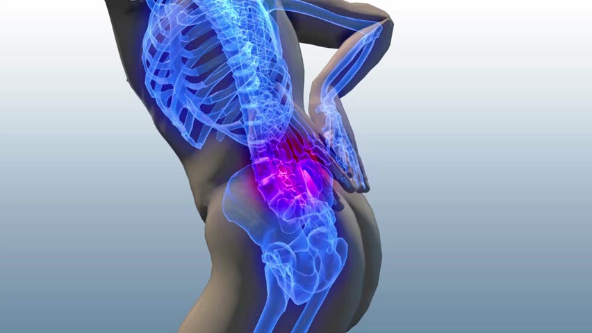 Understanding Lower Back Pain Causes, Symptoms, and Effective Treatment Options