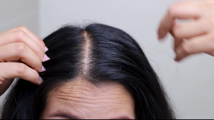 Woman is hair loss due to stress
