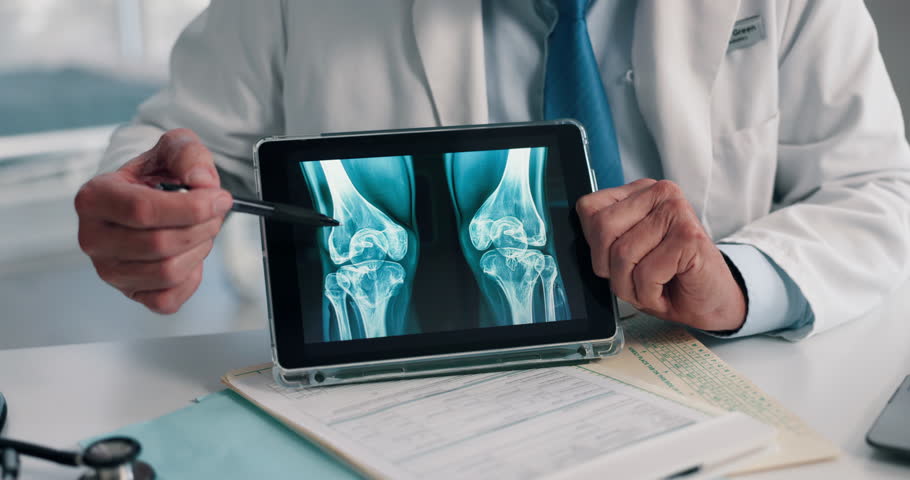 Doctor, hands and tablet for x ray with screen, knee and osteoporosis with point at hospital. People, application and medical consultation for arthritis, feedback and report for wellness at clinic