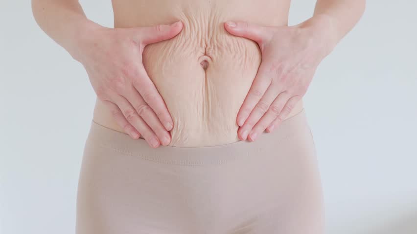 Female hands squeeze skin around belly button showing aging signs and loss of elasticity Wrinkled texture and sagging appearance