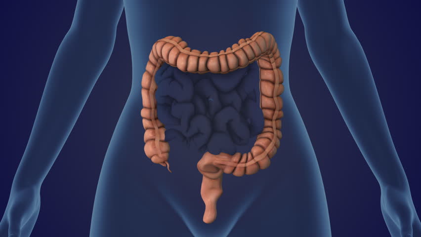 Irritable Bowel Syndrome Triggering Abdominal Pain and Discomfort