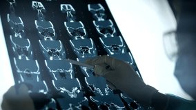 doctor inspecting mri scan in clinic. doctor’s gloved hand pointing at a CT scan of a human skull. Medical analysis, radiology, and healthcare diagnostics concept in a clinical environment  - Powered by Shutterstock - Get 15% off with code: PIKWIZARD15