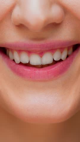 Portrait of Young Happy Woman Smiling Wide on Camera. Cute Glowing Face and Amazing Optimism of 30s Adult Girl. Enthusiastic Female Person with Pleased Grimace and Shining Healthy Teeth post Dentistry