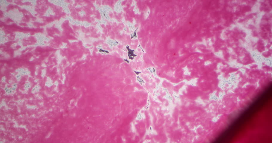 Chaotic swirling pink ink forming complex abstract organic pattern in white liquid under microscope slide showing cellular motion high detail close-up scientific view