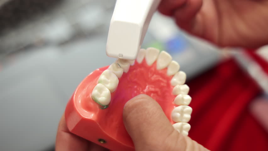 Dental Intraoral Scanner in Action, Tooth Model Being Digitally Captured in Clinic