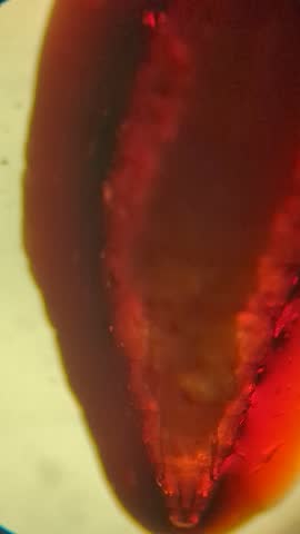 Live Maggot Under Microscope, Forensic Entomology Investigation Underway