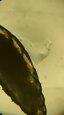 Live Maggot Under Microscope, Forensic Entomology Investigation Underway