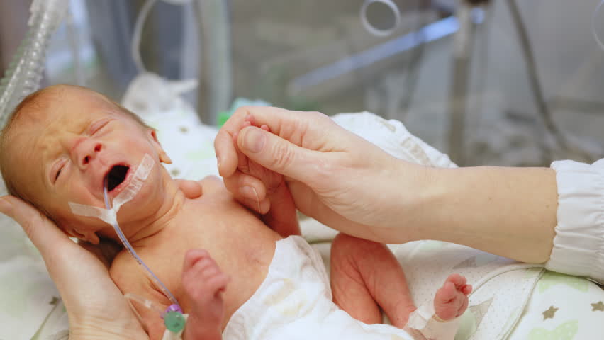 A premature baby receives care in a neonatal intensive care unit (NICU). A healthcare professional gently touches the infant's foot. Neonatal Intensive Care Unit
