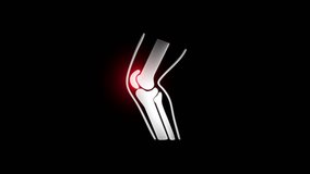 Neon animation of human knee joint pain icon on black background, glowing orthopedic anatomy illustration, medical health concept for bone injury, arthritis, digital diagnostics, and physiotherapy - Powered by Shutterstock - Get 15% off with code: PIKWIZARD15