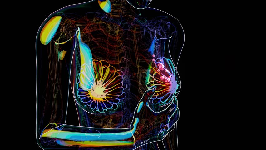 Conceptual Woman with breast cancer