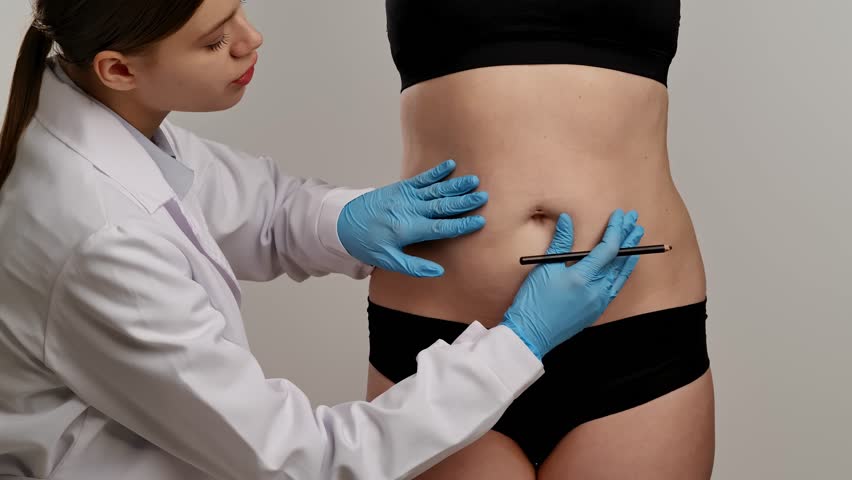 A medical professional in gloves marks lines on a patient's abdomen, indicating preparation for cosmetic surgery. Concept of plastic surgery, medical evaluation procedures and health. Slow motion