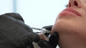 Beautician doctor makes botulinum toxin injection in the chin of young beautiful woman. Close up 4k shot - Powered by Shutterstock - Get 15% off with code: PIKWIZARD15