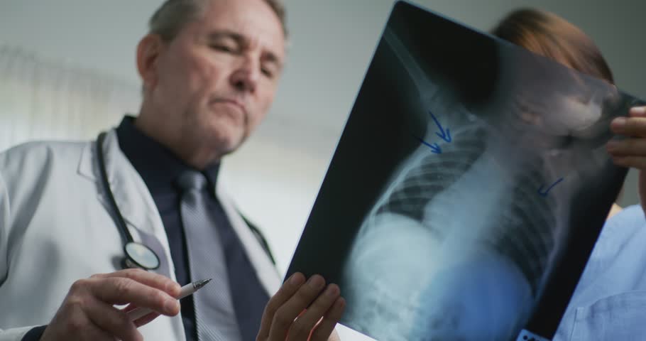 A male doctor and female nurse closely inspect an X-ray image, focusing on diagnosis or patient case review in a clinical setting.