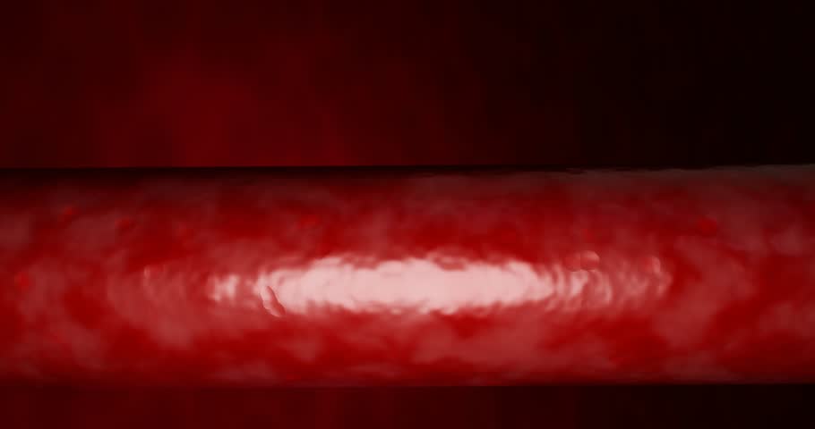 Blocked artery filled with accumulation of fat, cholesterol plaques, blood clots, unhealthy foods, and sugary beverages, illustrating risks of heart disease, stroke, and vascular damage. 3D rendering.