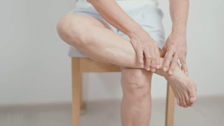 Elderly woman having leg pain due to Ankle Sprains or Achilles Tendonitis and Shin Splints ache. injury, hyperuricemia disease, Gout,Senior Health care and medical treatment  concepts 