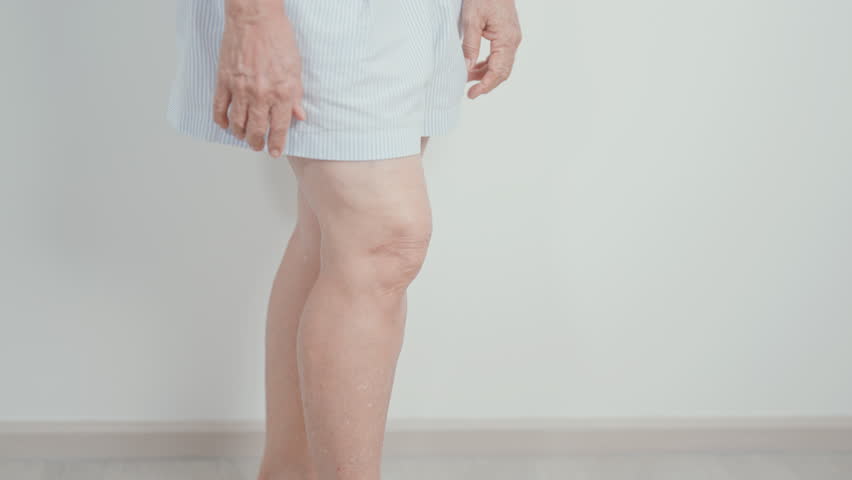 Elderly woman having Calf pain for concepts of Calf Muscle Strain, muscle pull, Leg Cramp, Sprain, aches, Varicose Veins, Deep Vein, world Thrombosis day, Senior Health care and medical treatment 