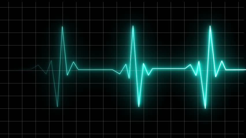 A looping heartbeat animation with a vibrant blue ekg rhythm on a black grid background. Perfect for medical, healthcare, or science projects.