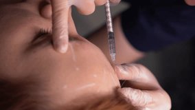 Beautician doctor makes botulinum toxin injection in the forehead of young beautiful woman. Close up vertical 4k shot - Powered by Shutterstock - Get 15% off with code: PIKWIZARD15