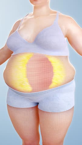 Burn belly fat to lose weight, woman fitness and body shaping by fat cell burning, obese people become slimmer, body management solution, 3D animation.