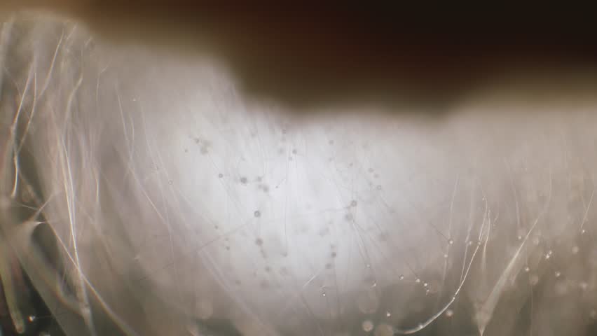 Mold colony aerial hyphae and sporangium focus ramping view