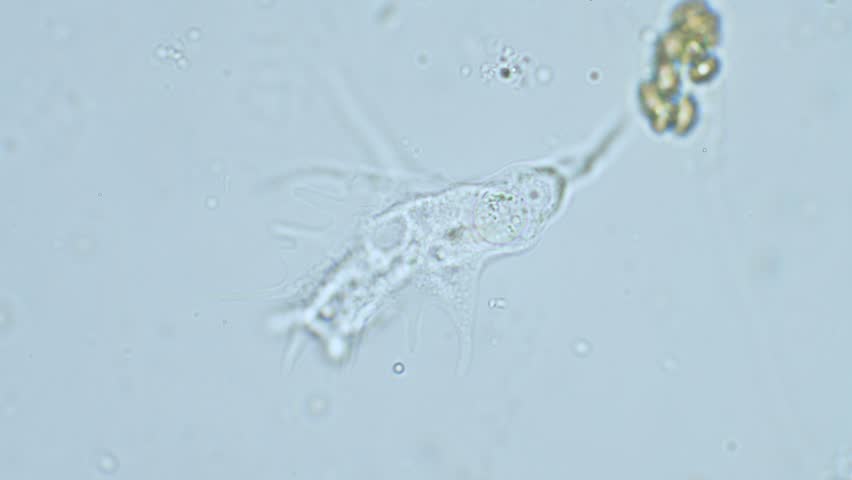 Single cell organism moving amoeba under microscope