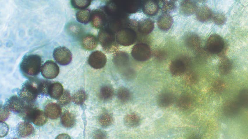 Slime mold spores in large magnification with visible surface details