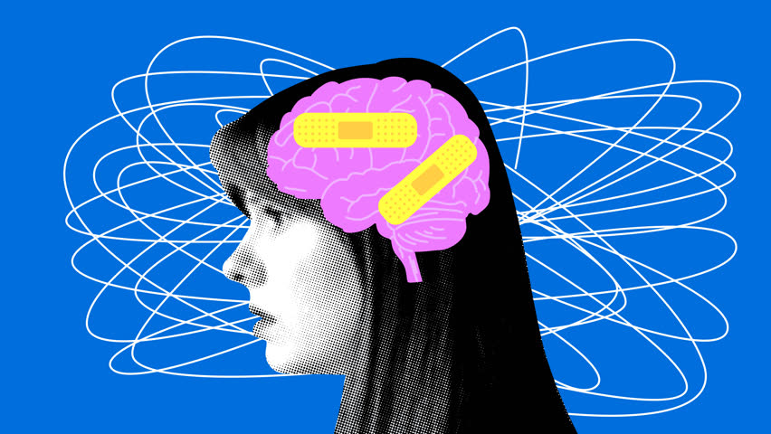 Modern collage with female head and brain covered with plaster bandage. Concept of mental health, dementia, headache. Head trauma, amnesia. Animation, stop motion