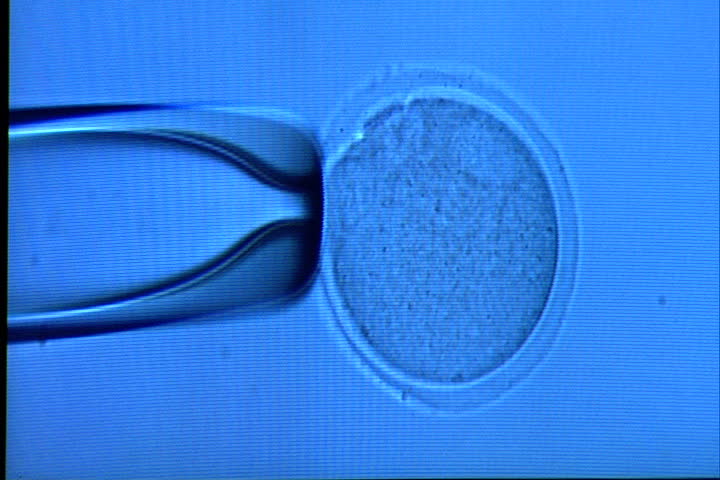 NEW YORK CITY - CIRCA APRIL 2000: Human egg on monitor screen