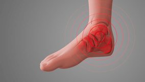 Osteoarthritis Causing Pain in Foot and Ankle - Powered by Shutterstock - Get 15% off with code: PIKWIZARD15