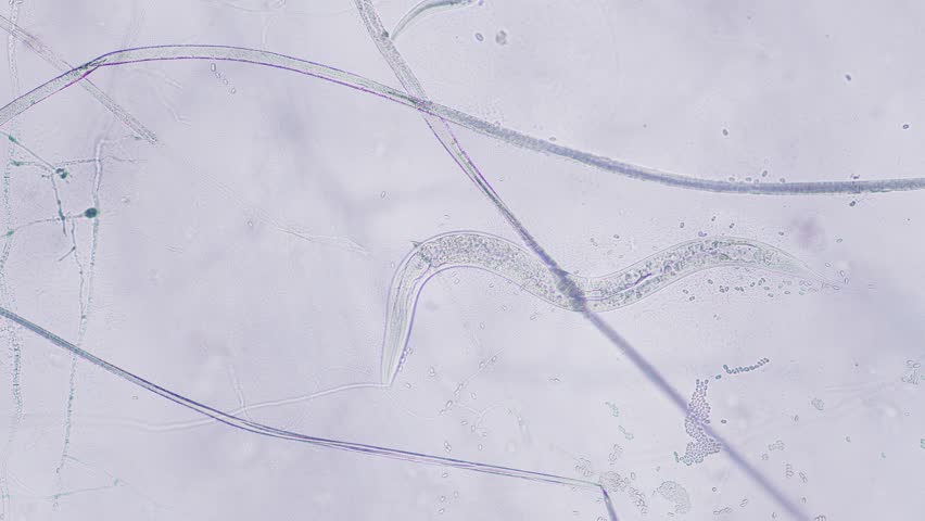 Nematode under microscope bright field view
