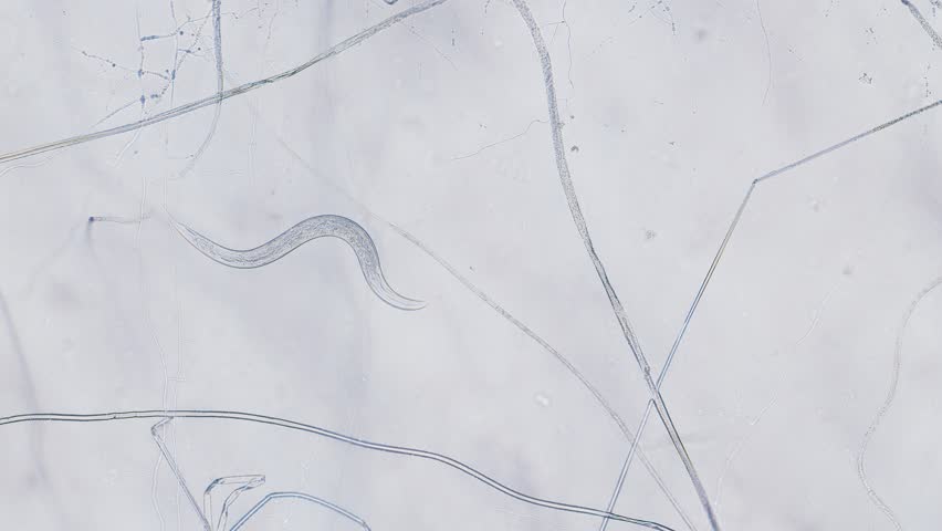 Nematode under microscope bright field view