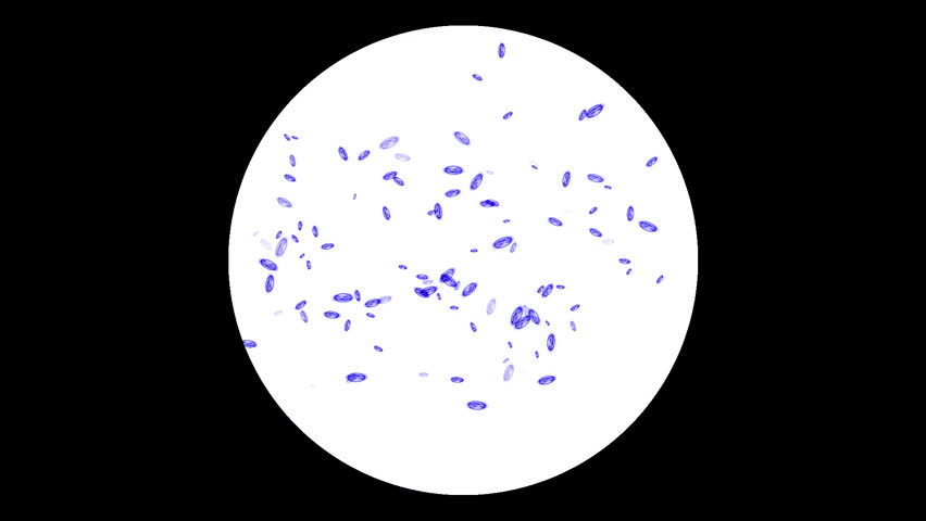 Bacteria or microbes under microscope