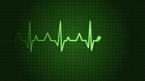 Electrocardiogram Heartbeat Line Animation, Heartbeat Monitor Animation with Spiking Signal Line in Medical Theme - Powered by Shutterstock - Get 15% off with code: PIKWIZARD15