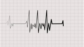 Electrocardiogram Heartbeat Line Animation, Heartbeat Monitor Animation with Spiking Signal Line in Medical Theme - Powered by Shutterstock - Get 15% off with code: PIKWIZARD15