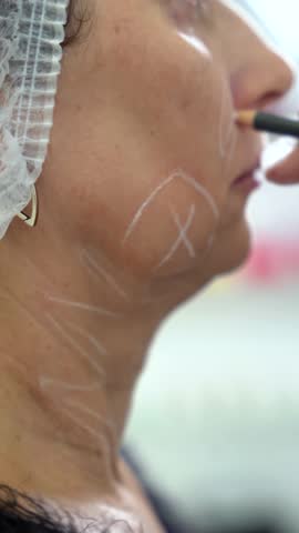 A female cosmetologist makes marks on woman face for injections in a modern cosmetology center. Injection cosmetology, surgery, facelift and rejuvenation
