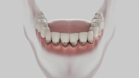 Ultrasonic teeth cleaning animation. Professional dental hygiene procedure in stunning 3D animation. - Powered by Shutterstock - Get 15% off with code: PIKWIZARD15