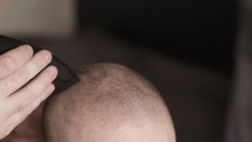 Trimmer Shaving Bald Woman’s Head,Final Step Before Cancer Therapy - Powered by Shutterstock - Get 15% off with code: PIKWIZARD15