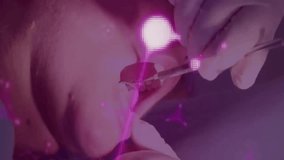 Animation of dentist with patient and data processing over dark background. Global artificial intelligence, research, connections, computing and data processing concept digitally generated video. - Powered by Shutterstock - Get 15% off with code: PIKWIZARD15