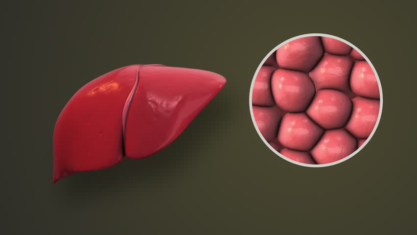 Hepatitis B Infection Damaging Liver Tissue Structure