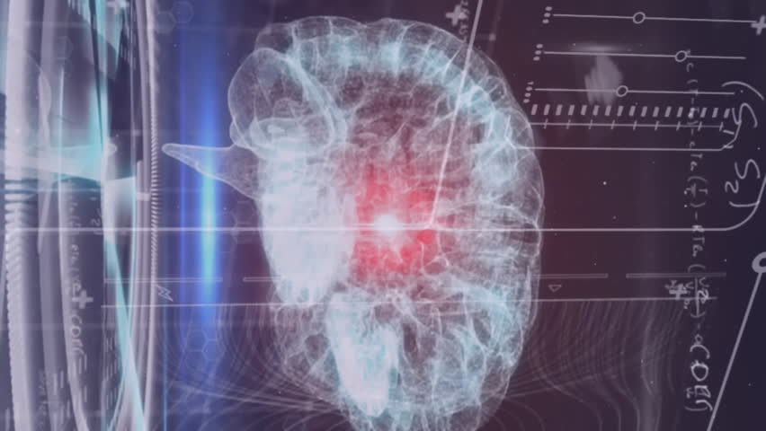 Animation of scope scanning and data processing over brain. Global business digital interface time and technology concept digitally generated video. - Powered by Shutterstock - Get 15% off with code: PIKWIZARD15